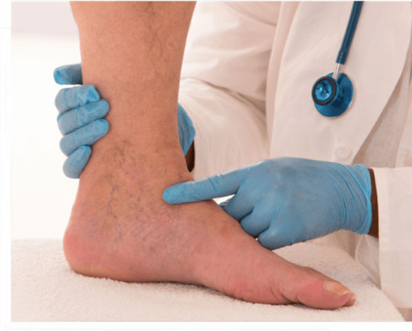 Vein screening