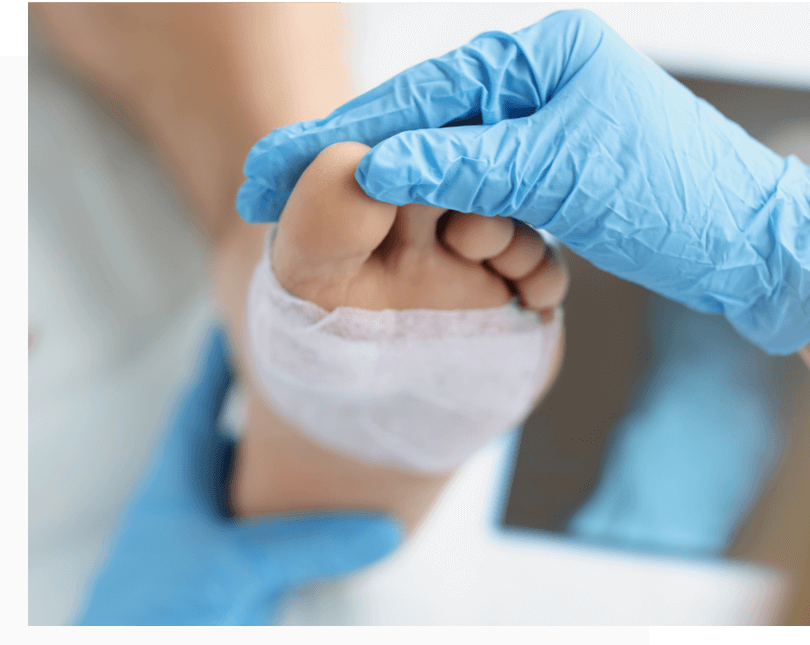 Vascular doctor treating patient with a vascular wound