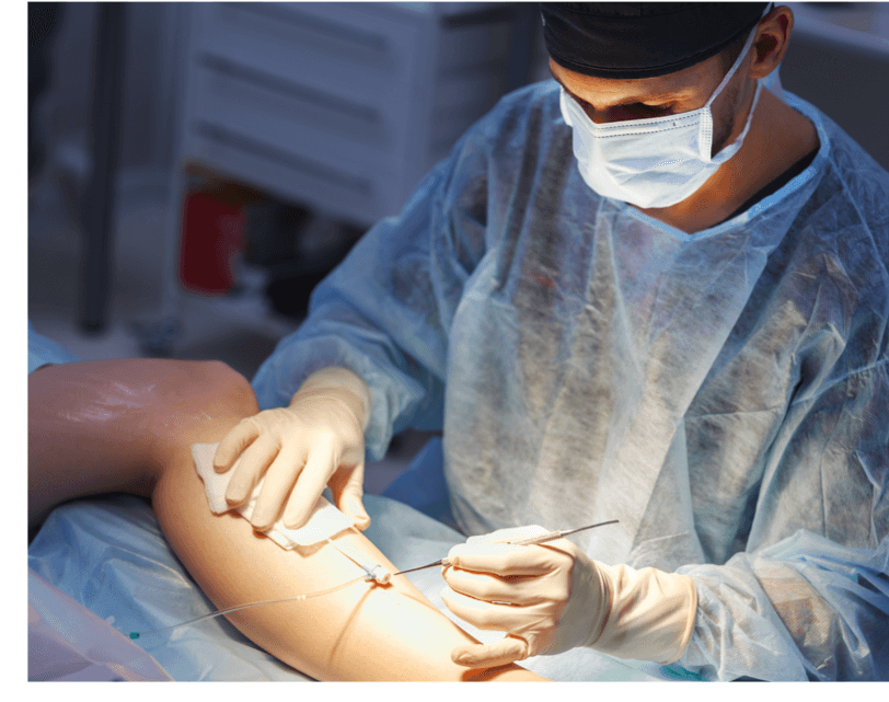 vein-surgery-splash Varicose vein surgery