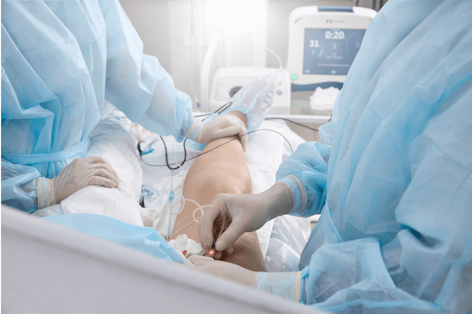 Vein ablation procedure