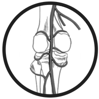 Genicular artery embolization leg pain icon