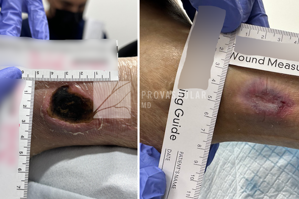 Wound care before after images
