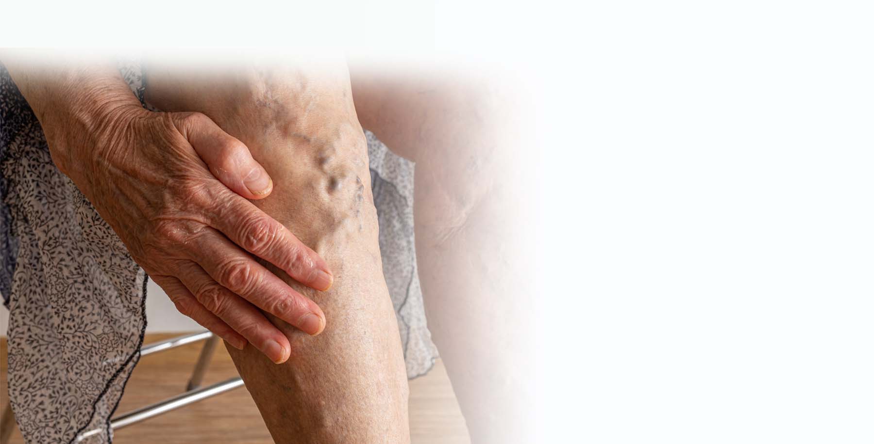 Vascular Ulcers